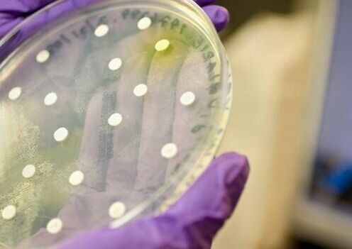 bakterijska kultura za dijagnozu prostatitisa